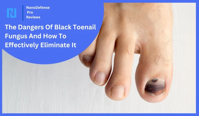 The Dangers Of Black Toenail Fungus And How To Effectively Eliminate It