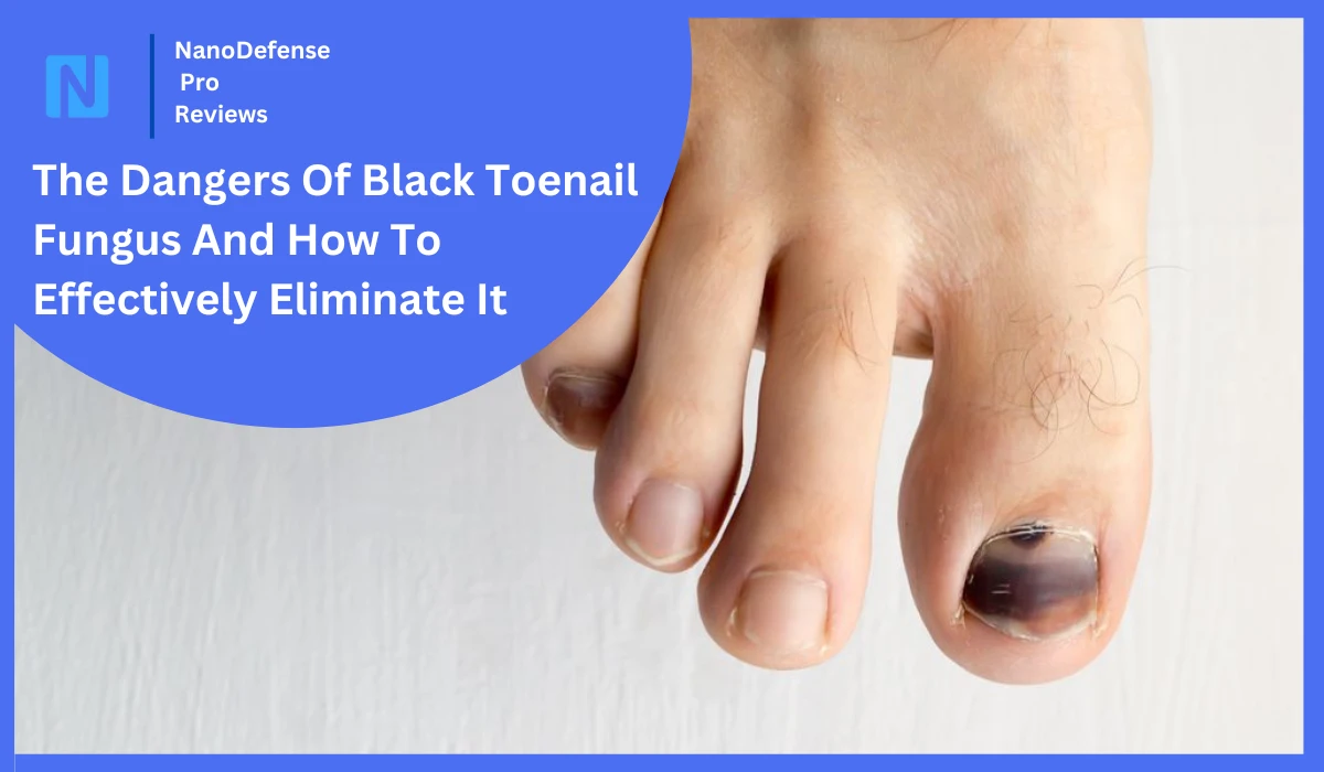 Black Toenail Fungus