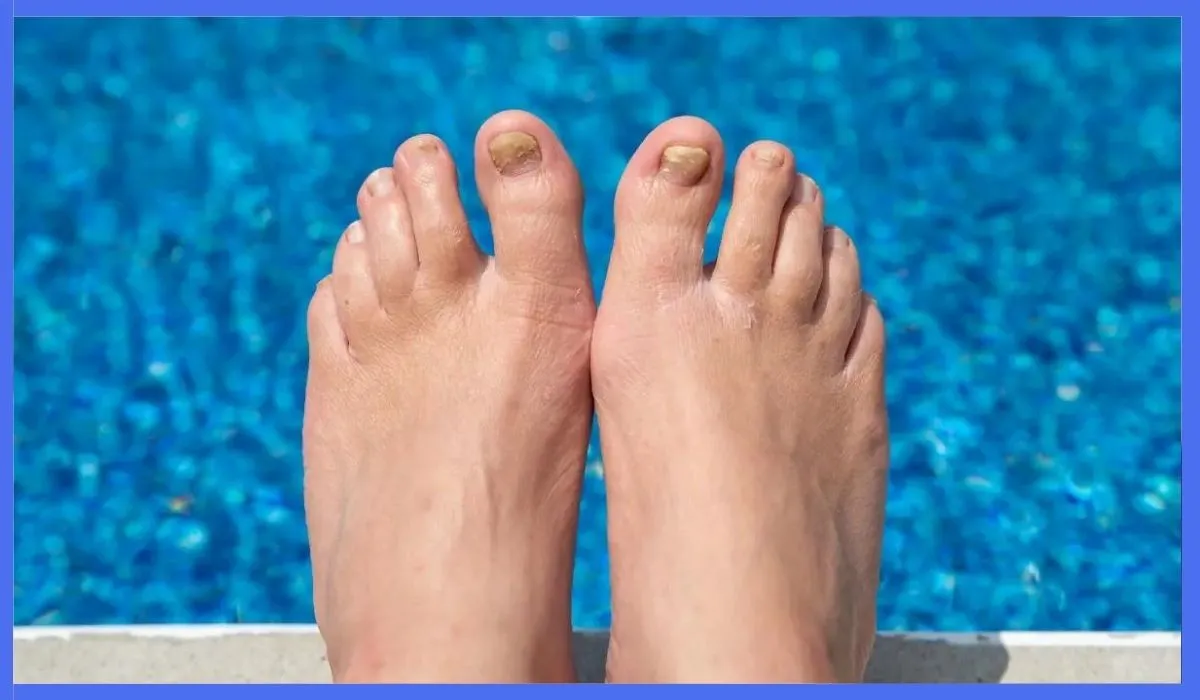 How Foot Baths Can Help Toenail Fungus