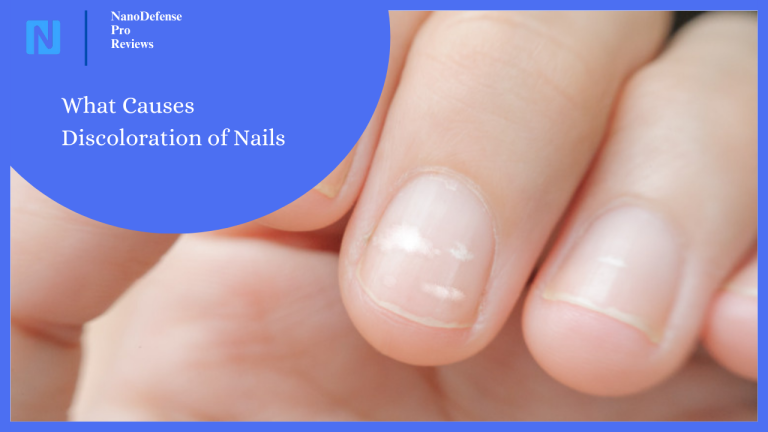 What Causes Discoloration of Nails: Understanding Nail Color Changes