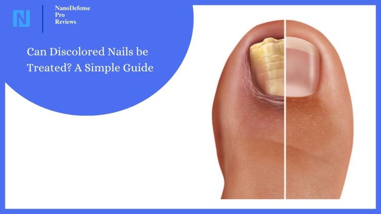 Can Discolored Nails be Treated? A Simple Guide