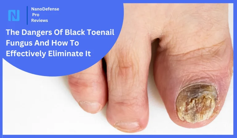 What Kills Toenail Fungus Instantly? The Proven Remedies That Work Fast