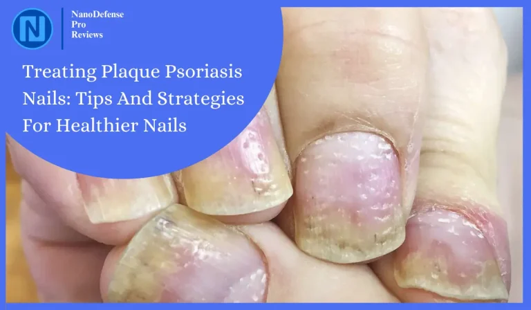 Treating Plaque Psoriasis Nails: Tips And Strategies For Healthier Nails